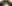 生え際の植毛（ヘアライン植毛） — 清潭OKクリニック