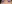 裏ハムラ法（経結膜的眼窩脂肪移動術） — プレジャー美容外科クリニック
