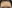 額縮小術（生え際下げ・ヘアライン下降術） — ヒート美容外科クリニック