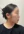 PRP自體脂肪移植（自體脂肪填補＋高濃度血小板血漿） — 術後 (60天) · Beauty Line 醫美診所