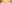 裏ハムラ法（経結膜的眼窩脂肪移動術） — ファクト美容外科クリニック