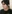 Bulbous nose correction (surgical nasal tip reduction) — DM Plastic Surgery Clinic