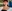 Alar base reduction (alarplasty) — Anersty Plastic Surgery Clinic