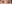 眼瞼下垂手術（目つき矯正） — プロミス美容外科クリニック