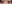 涙袋ヒアルロン酸注入（涙袋形成） — フルルン美容外科クリニック