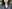 顔の脂肪吸引 — ドクター・ジョン リバンクリニック
