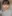 小鼻縮小術 — コ・アン・ミ美容外科クリニック