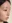鼻尖形成術（自家軟骨移植） — ダルビ美容外科クリニック