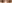 切開法（全切開法二重術） — ルホ美容外科クリニック
