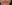 Lip filler (lip augmentation with HA) — Private Beauty Clinic Jiyu