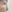 小鼻縮小術 — エックスオー美容外科クリニック