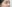 鼻尖形成術（自家軟骨移植） — エイト美容外科クリニック