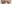 二重まぶた（自然癒着法） — ポップ美容外科クリニック