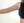 Brachioplasty (arm lift) — after (30days) · Cheongdam OK Plastic Surgery Clinic