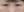 Eyelid filler (upper eyelid hollowing correction) — after · The Ollim Plastic Surgery Clinic
