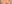 Lower Eyelid Fat Repositioning (transconjunctival) — Pleasure Plastic Surgery Clinic