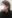 糸リフト（スレッドリフト） — ハッシュ美容外科クリニック
