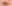 口角挙上 — ライク美容外科クリニック