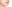 歯列矯正（矯正歯科） — セラミック歯科クリニック