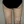 Full-body liposuction — after (21days) · Aurora Clinic