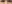 裏ハムラ法（経結膜的眼窩脂肪移動術） — スウェイ美容外科クリニック