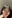 唇のヒアルロン酸注入（リップヒアルロン酸） — ドレス美容外科クリニック