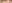 僧帽筋ボトックス（肩ボトックス） — ハッシュ美容外科クリニック