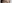 二重まぶた（自然癒着法） — プロミス美容外科クリニック