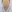 ดูดไขมันใต้คาง (เหนียง) — คลินิกฟิตติ้ง