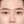 ลบรอยสักคิ้ว (ลบคิ้วกึ่งถาวร) — ก่อนทำ (7วัน) · คลินิก Apgujeong Beauty & Me