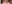 二重まぶた（自然癒着法） — ルホ美容外科クリニック