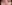 裏ハムラ法（経結膜的眼窩脂肪移動術） — リンク美容外科クリニック
