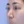 ผ่าตัดเอาสิ่งแปลกปลอมออกจากจมูก (เอาซิลิโคนจมูกออก) — ก่อนทำ (14วัน) · ไฮบอม ศัลยกรรมพลาสติก