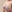 豊胸術（シリコンインプラント／人工乳腺） — エイト美容外科クリニック