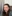 Under-eye (tear trough) fat grafting — Pleasure Plastic Surgery Clinic