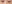 裏ハムラ法（経結膜的眼窩脂肪移動術） — ファクト美容外科クリニック