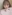 糸リフト（スレッドリフト） — ジャスト美容外科クリニック