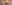 隆鼻術（シリコンプロテーゼ） — エイト美容外科クリニック