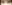 二重まぶた（自然癒着法） — オブジェ美容外科クリニック