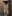 太ももの脂肪吸引 — ドクターマンゴークリニック