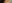裏ハムラ法（経結膜的眼窩脂肪移動術） — ジャスト美容外科クリニック