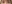 眼瞼下垂手術（目つき矯正） — エイペックス美容外科クリニック
