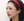 Paranasal (nasal base) augmentation with implant — after (50days) · iLumi Plastic Surgery Clinic