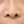 Chemical peel — after (28days) · J.Fill Clinic - Gangnam Branch