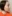 スキンボトックス（マイクロボトックス） — セギム美容外科クリニック