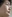 エラ削り（下顎角形成・エラ骨切り） — D.A.美容外科クリニック