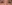 二重まぶた（自然癒着法） — フルルン美容外科クリニック