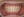 Metal bracket braces (traditional fixed orthodontics) — after (115days) · Yeonse Bareun Dental Clinic