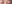二重まぶた（自然癒着法） — ルホ美容外科クリニック