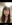 鼻尖形成術（自家軟骨移植） — ザ・タイト美容外科クリニック